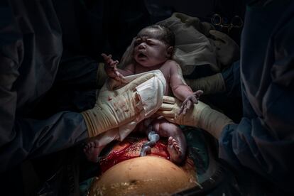 Una criatura neix per cesària a la Maternitat de l’Hospital Clínic.