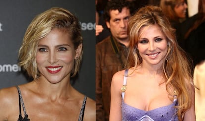 Elsa Pataky presume de llevar una vida sana pero su imagen también denota cambios estéticos.