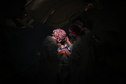 Villalba opera en un quirófano del Hospital del Mar a una paciente que sufre un tumor cerebral maligno.