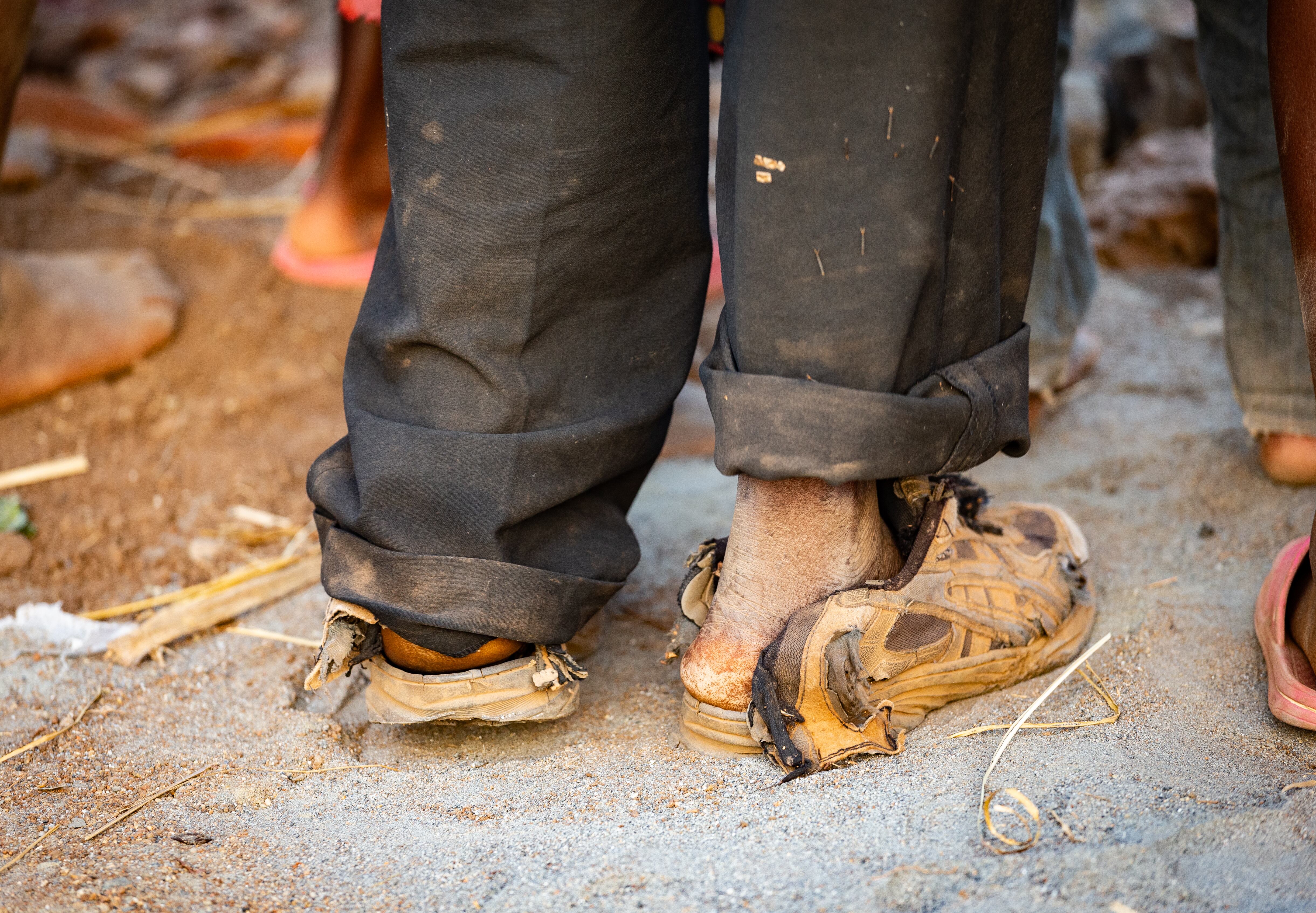 Un hombre con los zapatos rotos en Malaui, uno de los países que se han acogido formalmente a la iniciativa de alivio de la deuda puesta en marcha en plena pandemia por el G20. 