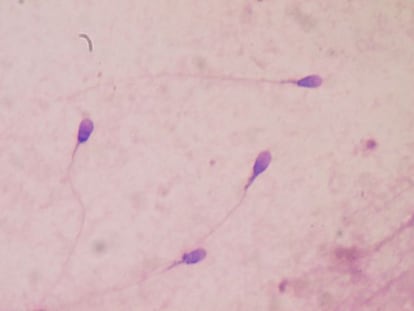 Espermatozoides humanos vistos al microscopio