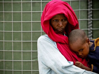 Un niño desnutrido espera a recibir atención médica en Mogadiscio, la capital de Somalia, en octubre de 2019.