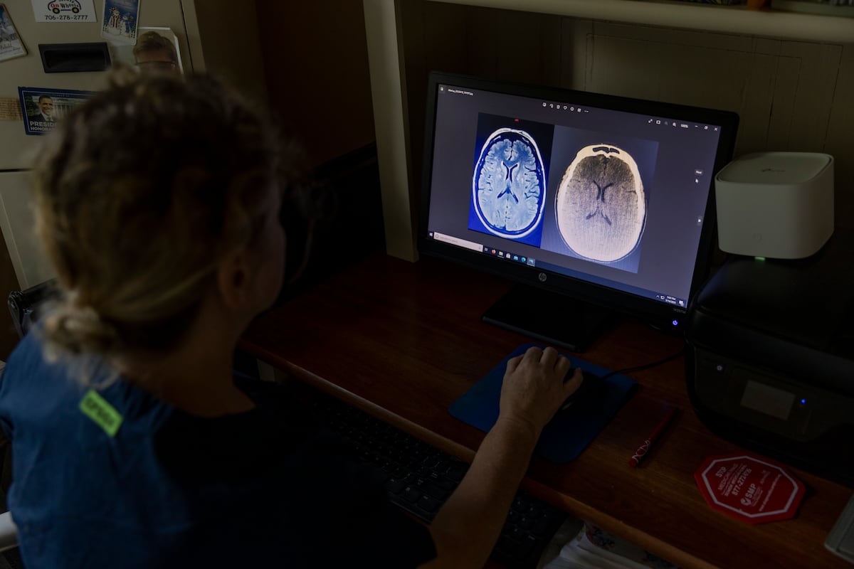 Así es como los científicos pretenden evitar que el alcohol y las drogas secuestren el cerebro