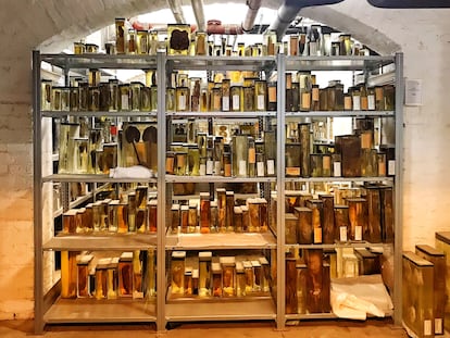 Colección de pulmones conservada en los sótanos del Museo de Historia de la Medicina Cahrité de Berlín.