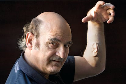 Stelarc, artista multimedia que se ha implantado una oreja en un brazo