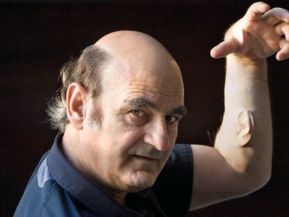 Stelarc, artista multimedia que se ha implantado una oreja en un brazo