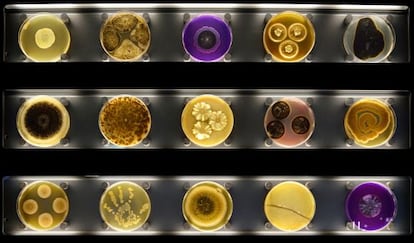 El perfil de la flora bacteriana del vello p&uacute;bico es m&aacute;s estable que el de otras zonas del cuerpo. Imagen cedida por Micropia, el museo del microbioma humano.