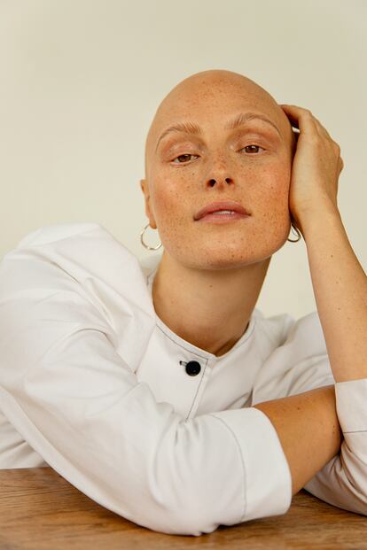 Amber Rowan, fotografiada por Thea Caroline Sneve Løvstad. La modelo desarrolló alopecia en la adolescencia y ahora lidera Hair Free Life, una asociación que apoya e informa sobre esta enfermedad autoinmune.