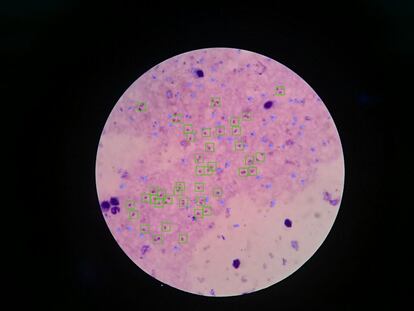 “Mediante programas específicos se juntan los resultados de varios jugadores para crear un único análisis con la misma precisión que la de un experto microscopista. En la foto aparecen los resultados sobre una imagen tras aplicar el algoritmo de inteligencia artificial, cuadrados verdes sobre las estructuras que se consideran parásitos y puntos rojos correspondientes a clics que han hecho los jugadores pero que el algoritmo ha descartado que puedan ser parásitos”, explican en MalariaSpot..