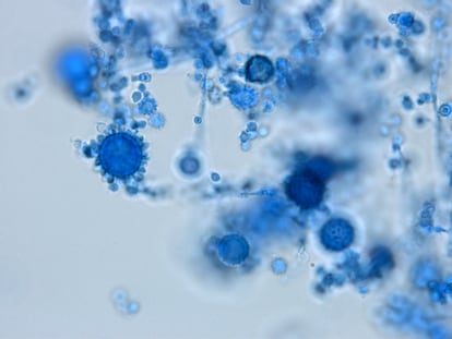 'Histoplasma capsulatum' visto al microscopio con tinción de azul. La inhalación de sus esporas puede provocar histoplasmosis, una enfermedad infecciosa pulmonar y hematógena.