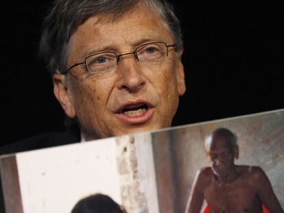 Bill Gates, con la foto de un caso de filariasis.