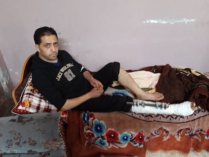 Refat al Buhaisi, torturado por fuerzas de seguridad de Hamás, en su casa de Deir el Balah (Gaza).