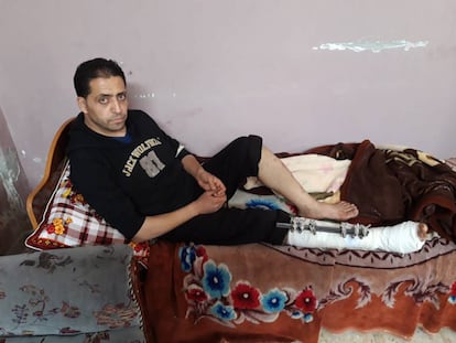 Refat al Buhaisi, torturado por fuerzas de seguridad de Hamás, en su casa de Deir el Balah (Gaza).