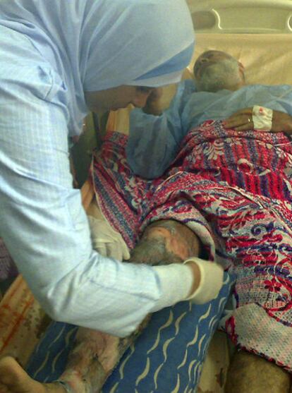 Una enfermera atiende a un hombre que se quemó en El Cairo.