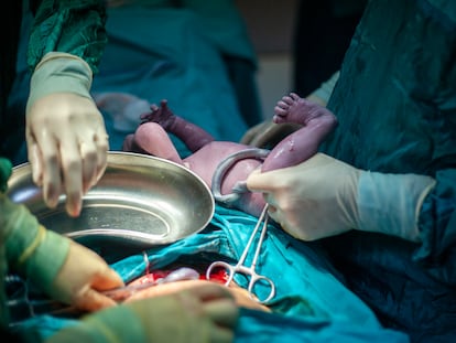 Un recién nacido por cesarea.