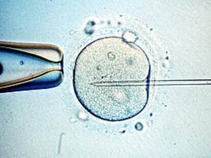 Microinyección de esperma en un óvulo para fecundarlo <i>in vitro.</i>
