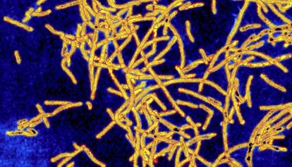 Imatge al microscopi de la 'Legionella pneumophila'.