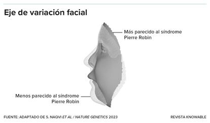 El síndrome de Pierre Robin (PRS) es un trastorno craneofacial caracterizado en parte por una mandíbula inferior pequeña, causado por una mutación en el gen regulador SOX9.