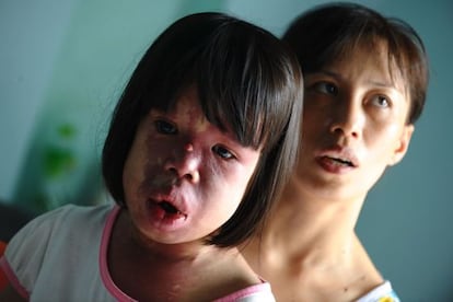 Nguyen Thi Hong Van, de 11 a&ntilde;os y supuesta v&iacute;ctima del &#039;agente naranja&#039;, con su madre en su casa de Danang. 
 