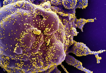 Micrografía electrónica de una célula humana muy infectada con partículas del virus SARS-COV-2.