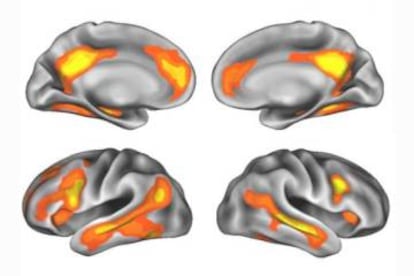 Las &aacute;reas del cerebro que m&aacute;s cambian durante el embarazo.