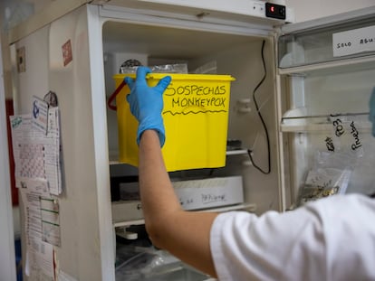 Una técnico de laboratorio recoge un cubo con muestras sospechosas de viruela del mono para analizarlas en Madrid, España, el 6 de junio de 2022.