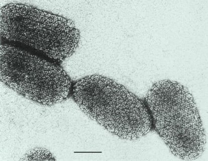 Virus de la rabia.