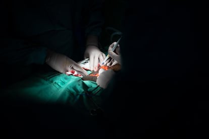 Intervención quirúrgica en un hospital español el pasado 19 de octubre.