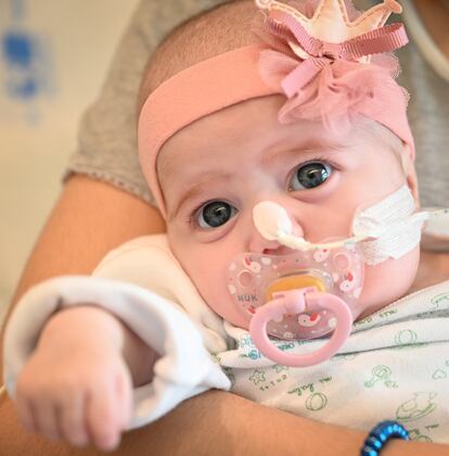 Naiara, de dos meses, tras recibir un trasplante de corazón.