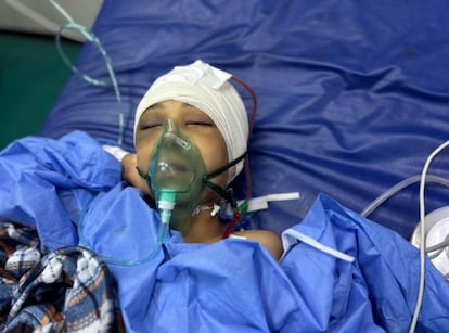 Misbah, de 9 años, es reoperada por los neurocirujanos para
tratar las complicaciones derivadas de una extensa craniectomía realizada con anterioridad. Misbah fue herida de bala en la cabeza por el ejército israelí. Si sobrevive, lo hará con la mitad izquierda de su cuerpo permanentemente
paralizada. (Jan Yunis, 30 de mayo de 2025).