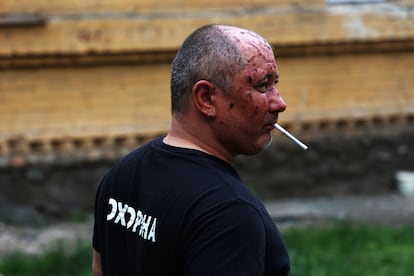 Un hombre con algunas heridas cerca de un edificio bombardeado por Rusia en Kiev. 