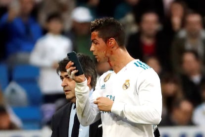 El delantero portugués del Real Madrid, Cristiano Ronaldo, se mira en un teléfono móvil tras ser golpeado en la cara.