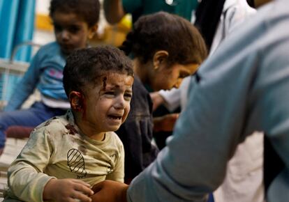 Niños palestinos heridos en un ataque israelí esperan a recibir tratamiento en el hospital Nasser, en Jan Yunis, en el sur de la franja de Gaza.
