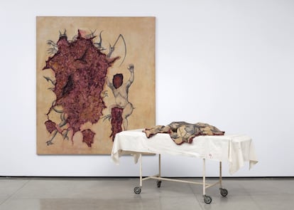 'Extirpação do mal por incisura' (1994), de Adriana Varejão.