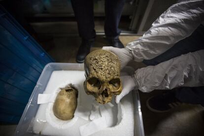 Bajo llave se guardan 300 cráneos con huellas de epidemias y deformaciones. En la imagen, un cráneo proveniente de Coahuila, de 1.000 años de antigüedad, afectado por la sífilis. Esto muestra que la enfermedad ya existía antes de la llegada de los españoles a América.