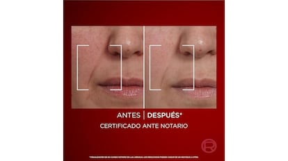 Esta crema de L´Óreal Revitalift Laser SPF 25​ combate las arrugas e hidrata profundamente.