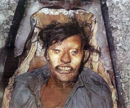El cadáver congelado de John Hartnell, uno de los tres primeros miembros de la expedición Franklin en morir, enterrado en la isla de Beechey en 1846 y examinado en 1980.