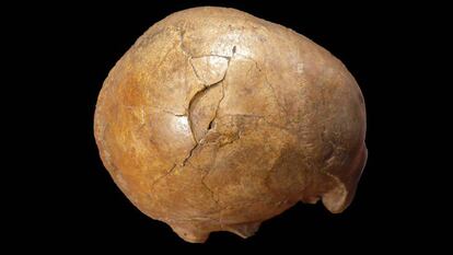 Una cráneo fracturado de hace 33.000 años hallado en Transilvania atestigua la violencia en la antiguedad. /