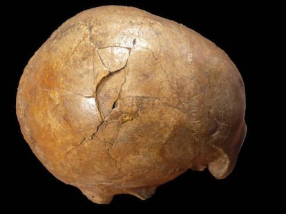 Una cráneo fracturado de hace 33.000 años hallado en Transilvania atestigua la violencia en la antiguedad. / 
