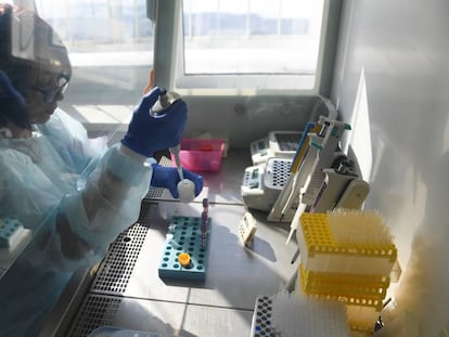 Una científica realiza pruebas bacteriológicas en el Instituto de Investigación de la Tuberculosis de Novosibirsk, Rusia.
 
 