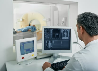 La tomografía computarizada de baja dosis de radiación, lo que normalmente se conoce como TAC, es la prueba recomendada para el cribado de cáncer de pulmón.