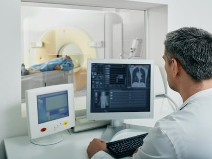 La tomografía computarizada de baja dosis de radiación, lo que normalmente se conoce como TAC, es la prueba recomendada para el cribado de cáncer de pulmón.