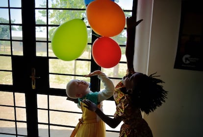 Una niña albina juega con globos, en la isla de Ukerewe durante el día Internacional del Conocimiento de Albinismo.