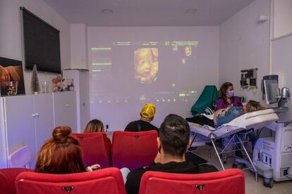 Cayetana Pingarrón se realiza una ecografía en 5D mientras su marido Mario Coloma y varios asistentes observan la proyección de la imagen en la pantalla del centro BabyCine.