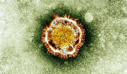 Imagen del virus que provoca la enfermedad.