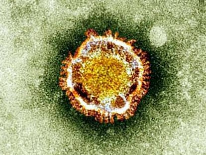 Imagen del virus que provoca la enfermedad.