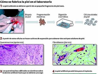 Cómo se fabrica la piel en el laboratorio