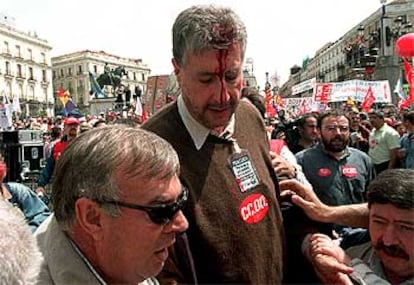 José María Fidalgo con el rostro ensangrentado, tras la agresión que sufrió el Primero de Mayo.