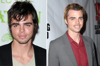 A sus 27 años, Reid Ewing, conocido por su papel de Dylan en la serie ‘Modern Family’, reconoció públicamente sufrir un trastorno dismórfico corporal, condición que le ha llevado a someterse a diversas operaciones estéticas desde 2008, cuando tenía 19 años, y le ha convertido en adicto a la cirugía plástica. "Antes de cambiar tu cara, fíjate si lo que debe transformarse es tu mente", dijo el actor al hacer pública su adicción al bisturí (a la izquierda, en una imagen de 2010 y, a la derecha, en 2014).