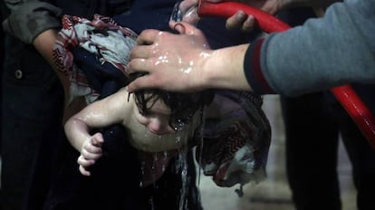 Un niño tratado en un hospital de Duma tras el supuesto ataque químico. 